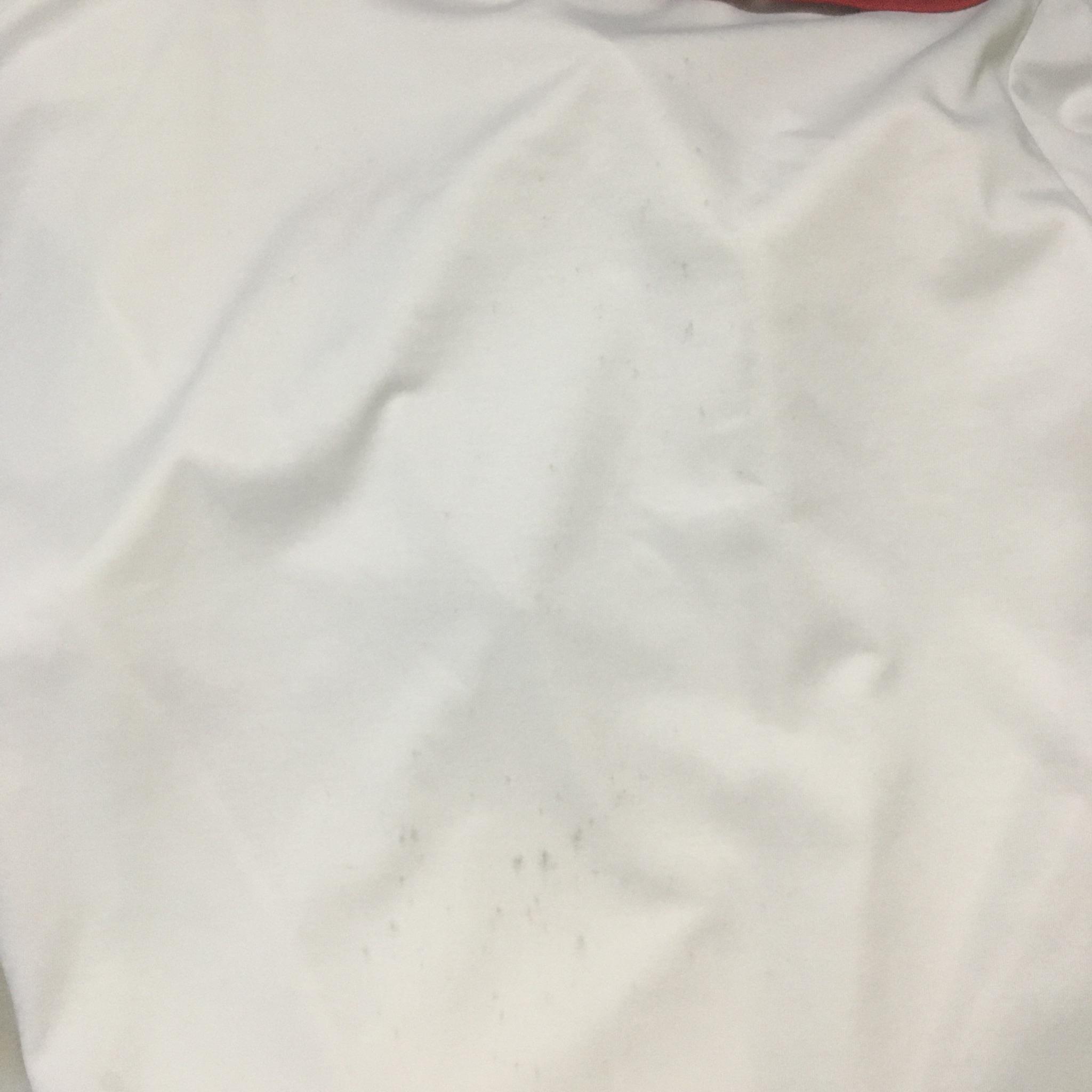 用什么可以洗掉衣服上的霉点 v2-9246cae6087cb7cb30f948774b3fae75_r.jpg