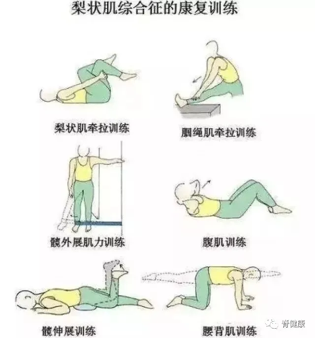 梨状肌综合征治疗方法