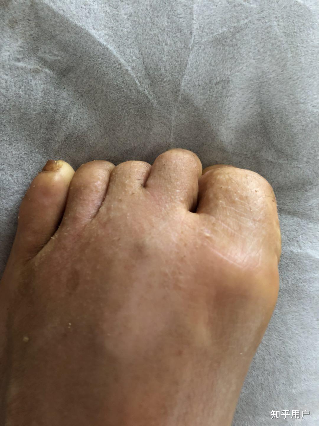 用孙叔公是一种怎样的体验?