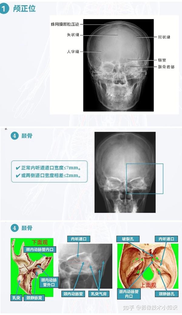 头颅X线摄影及其解剖 - 知乎