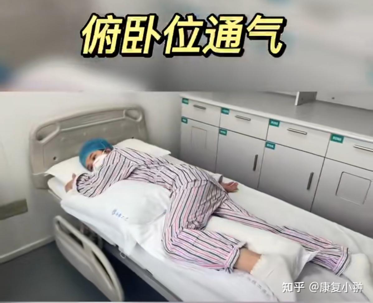 新冠治疗之一:俯卧位通气 - 知乎