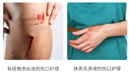 v2-9300b1a7922af9458129428a2606bbb6_1440w.jpg?source=172ae18b