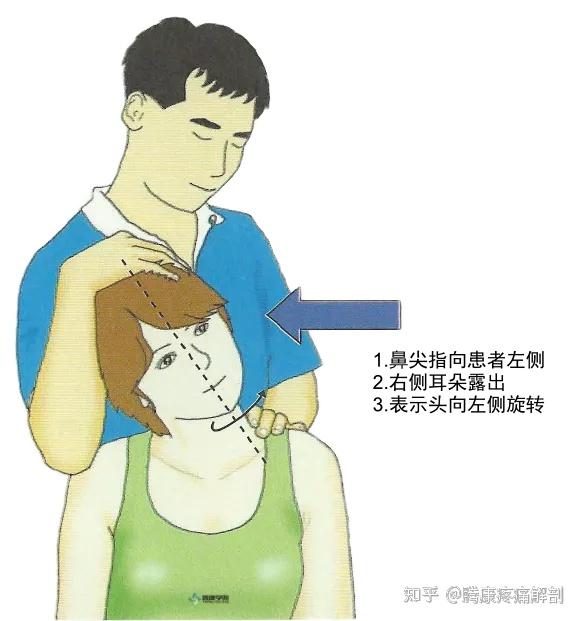 斜角肌综合征 zhuanlan.zhihu.com