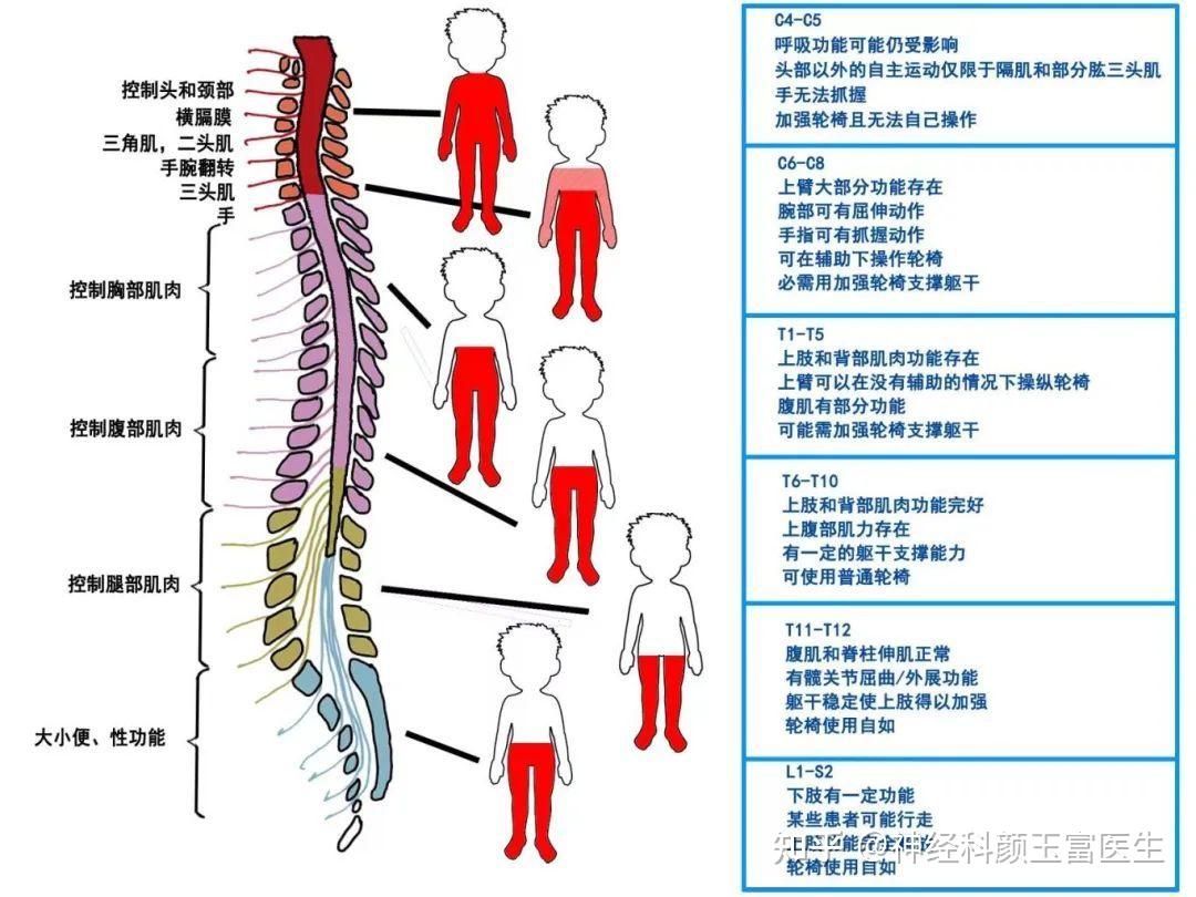 脊髓损伤：位置不同，症状表现差异明显，康复有技巧 - 知乎