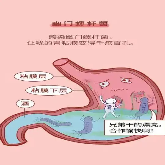 揭秘“鸡皮样胃炎”:胃黏膜的隐形杀手 - 知乎