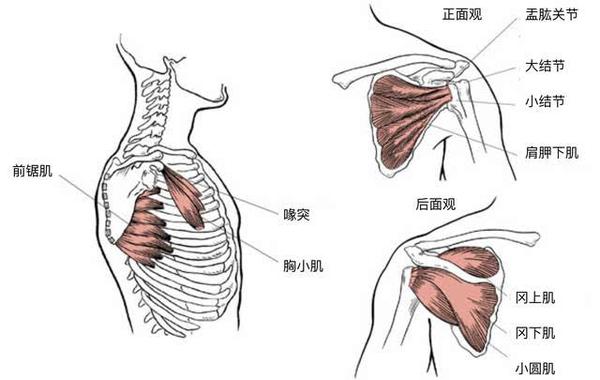 落枕問題不出在頸椎