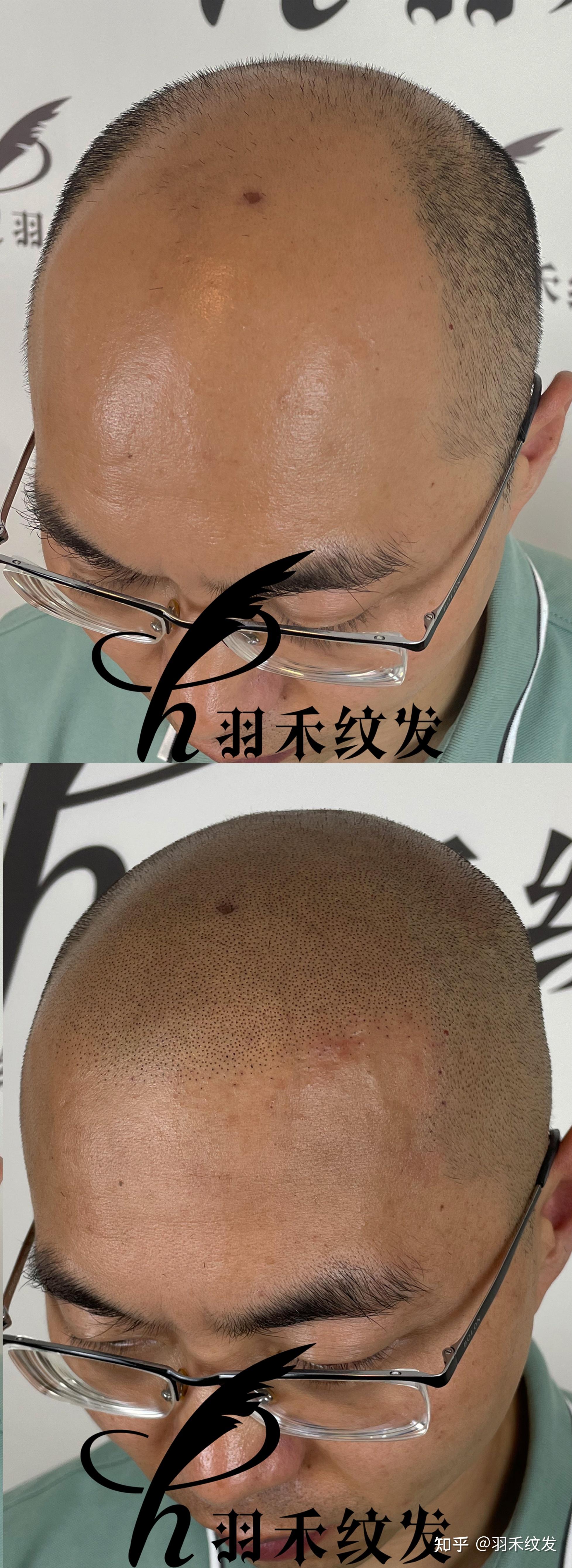 详解两次纹发固色的改变！ - 知乎