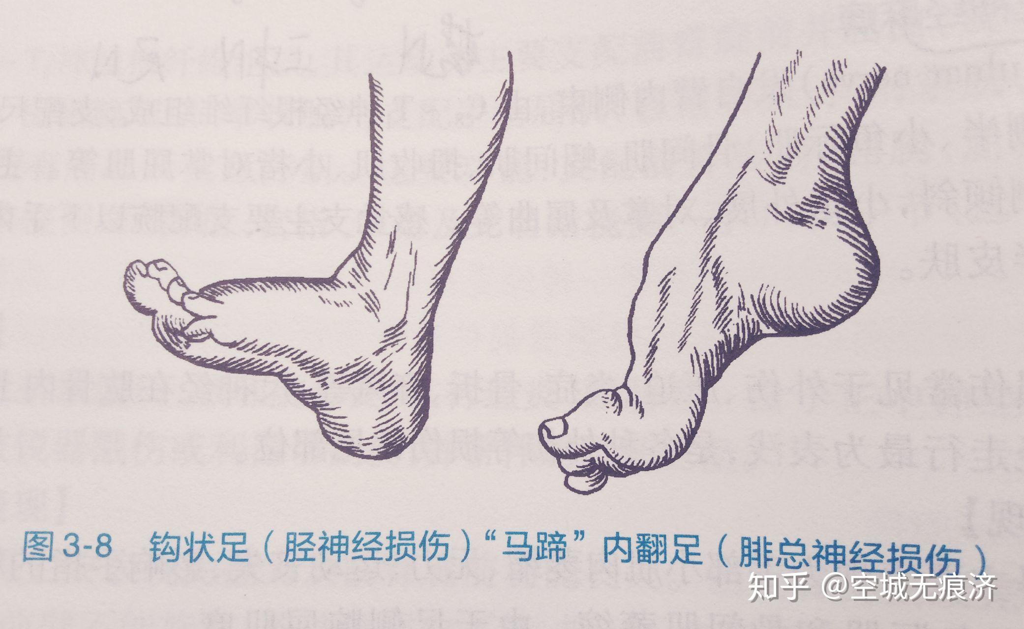 神经病学重要总结15