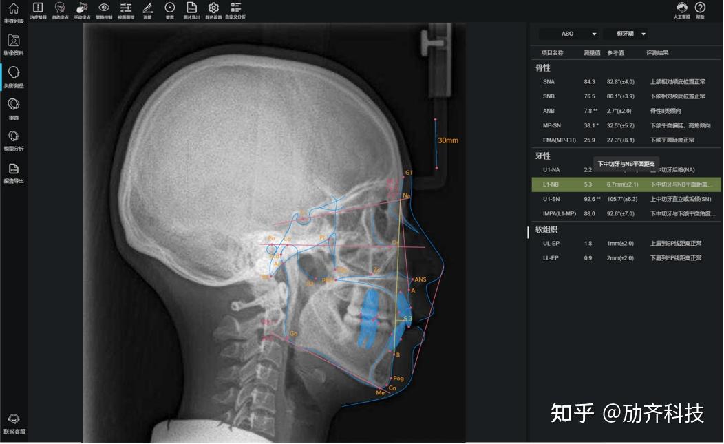 头影测量基准平面图片