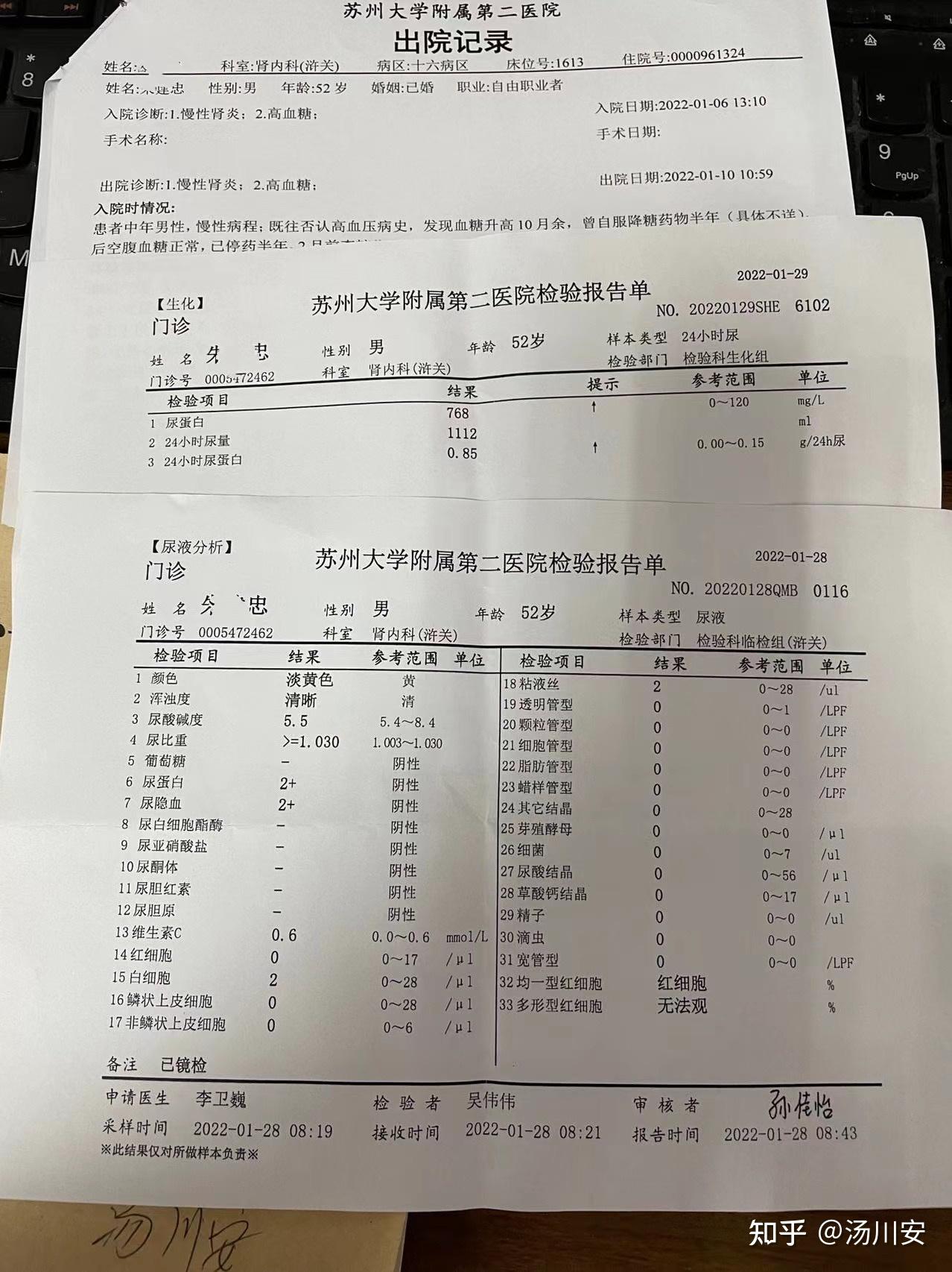 白细胞2 ,24小时定量很高,无浮肿,球蛋白低,住院诊断为慢性肾炎,西医
