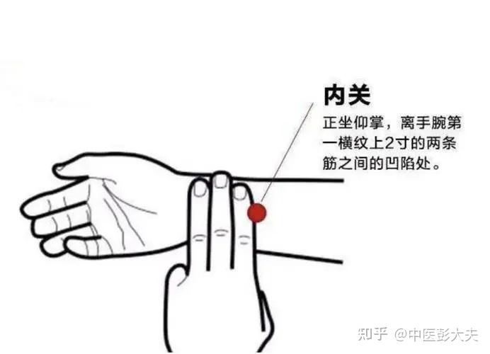 人体有一个“美人穴”——内关！ - 知乎