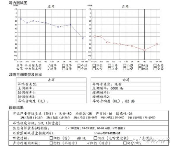耳鸣典型案例分享——声学干预治疗改善眩晕、耳鸣 - 知乎