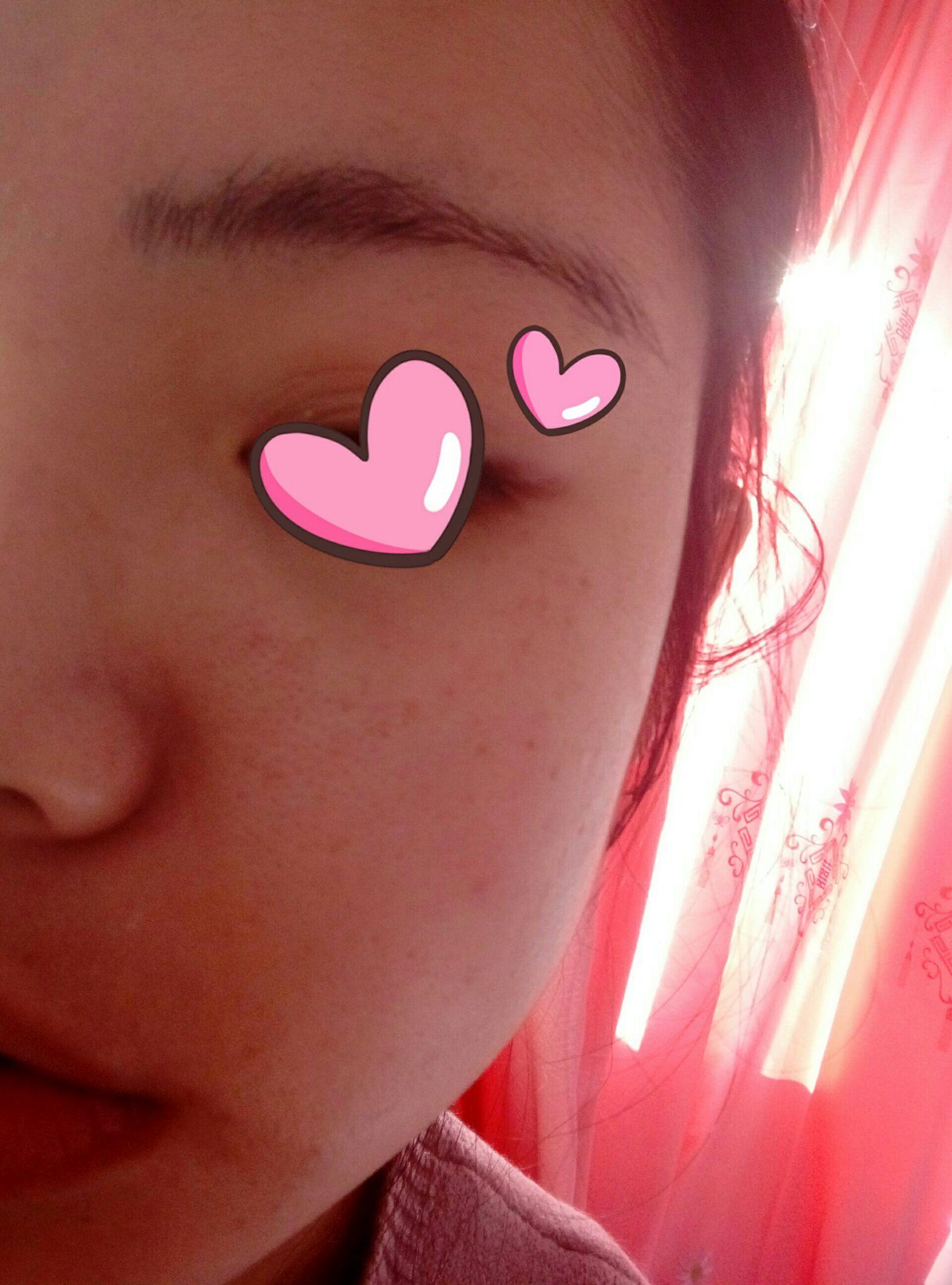 混合皮肤需要怎么护肤?