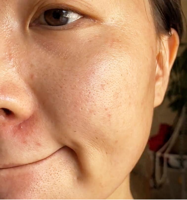 为什么明明每天都有在认真涂防晒霜,脸上还是粗糙暗沉,发黄的厉害?