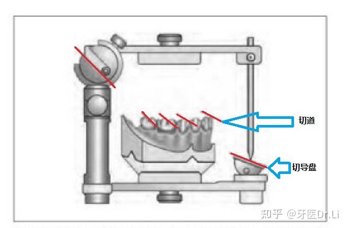 一个口腔修复学博士级的问题髁导斜度切道斜度切导斜度