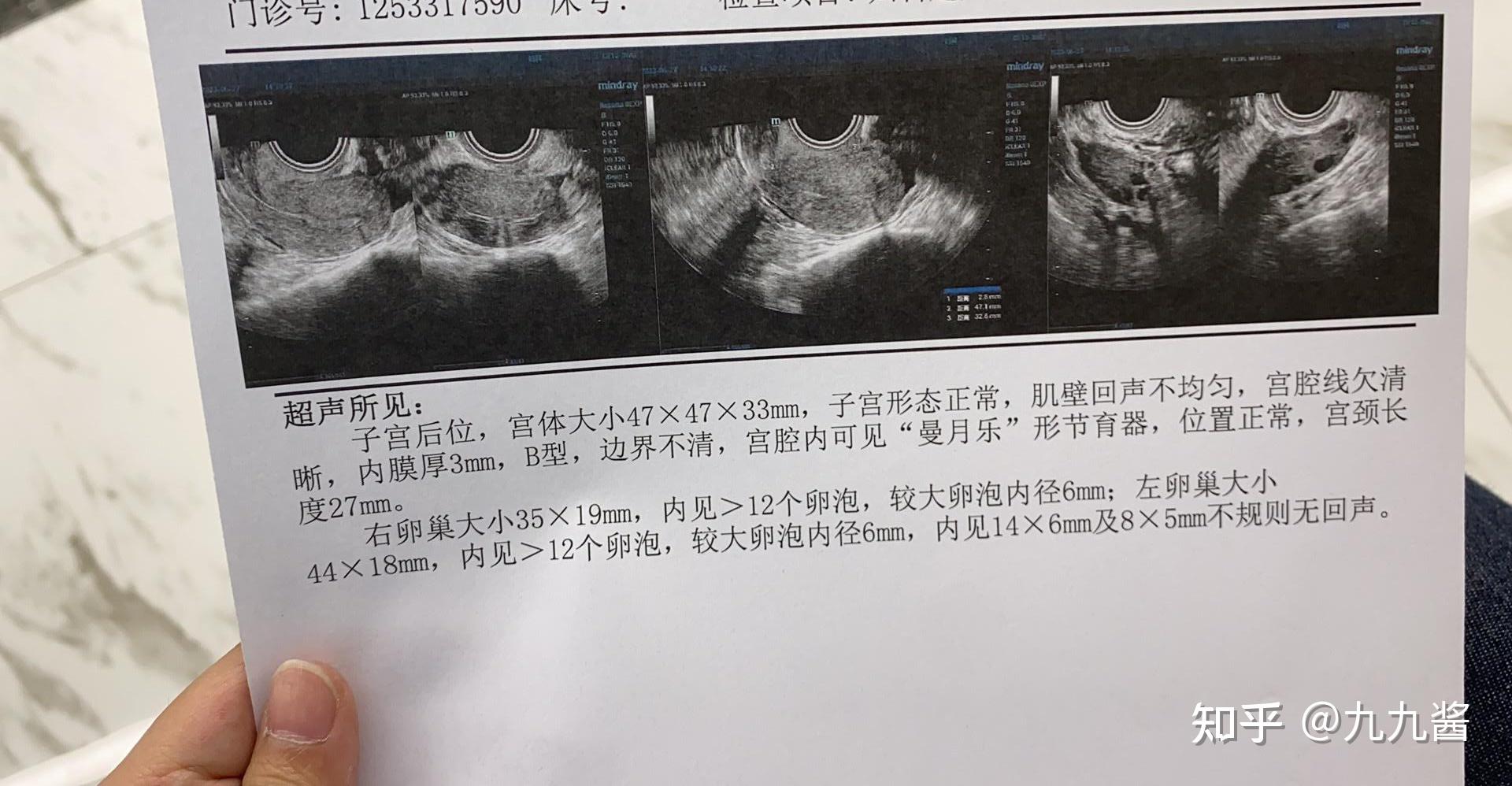 杨佳欣 杨隽钧图片