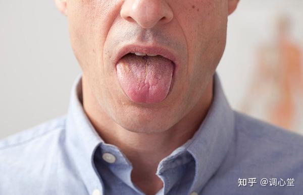舌头可谓是肾脏的“窗户”,肾脏好坏一看便知! - 知乎