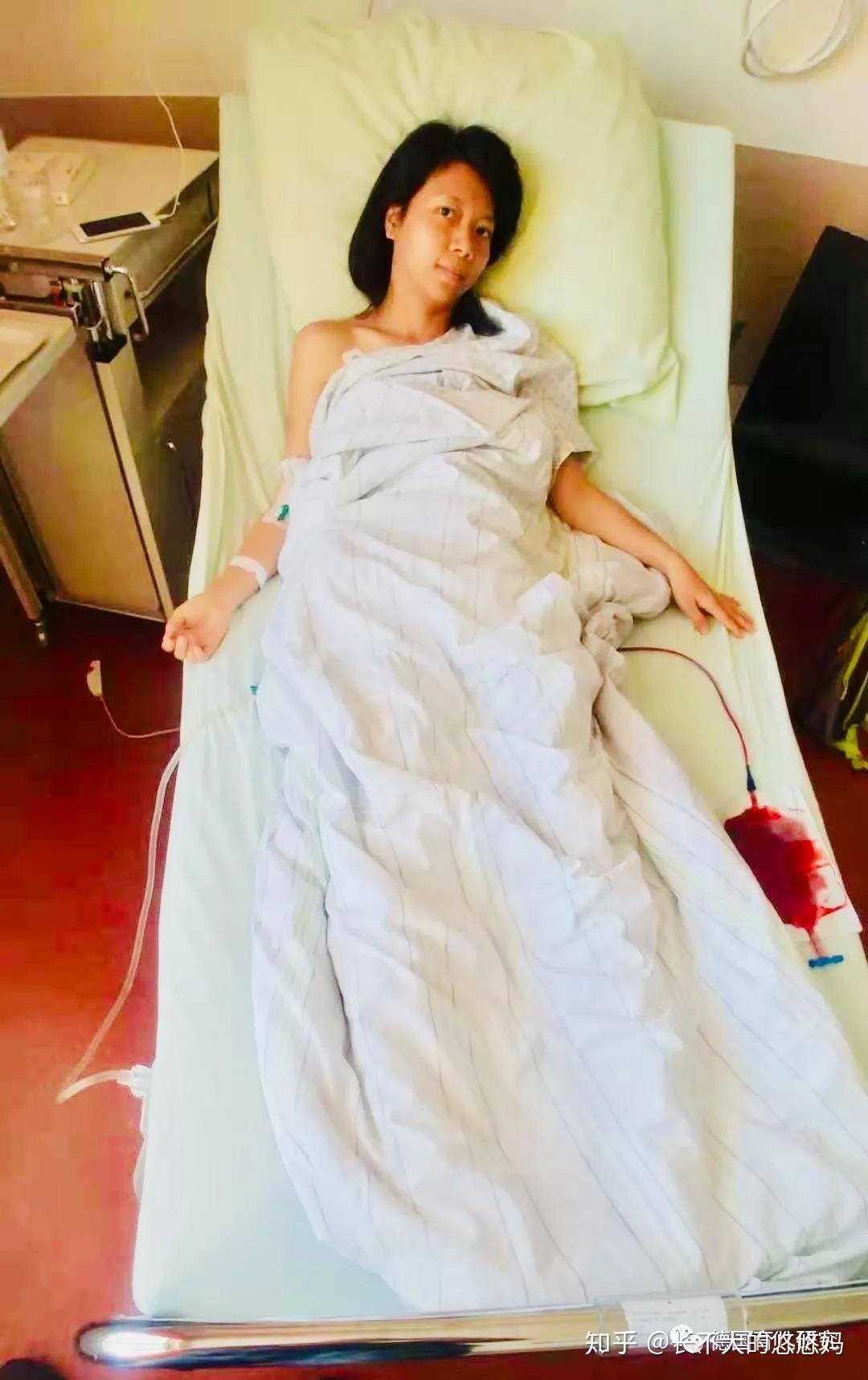 消失两周我在德国做了两次手术流了一盆血