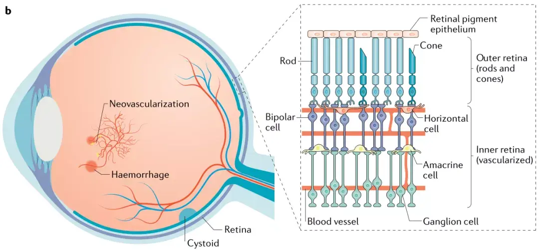 nature子刊|糖尿病視網膜病變的分子和病理生理學研究進展 - 知乎