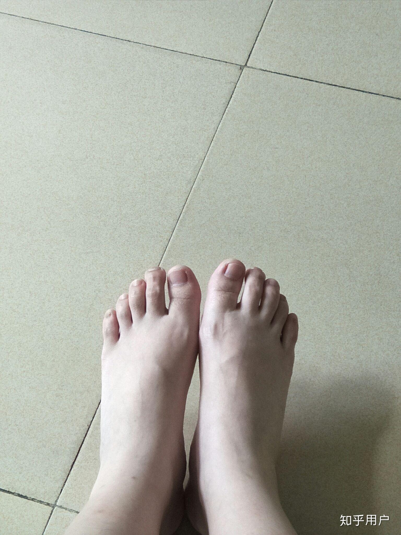 女生脚丑是种什么样的体验