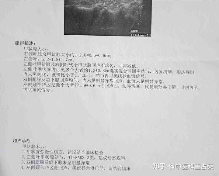 甲状腺结节3级变4级手术切除后又复发如何才能消