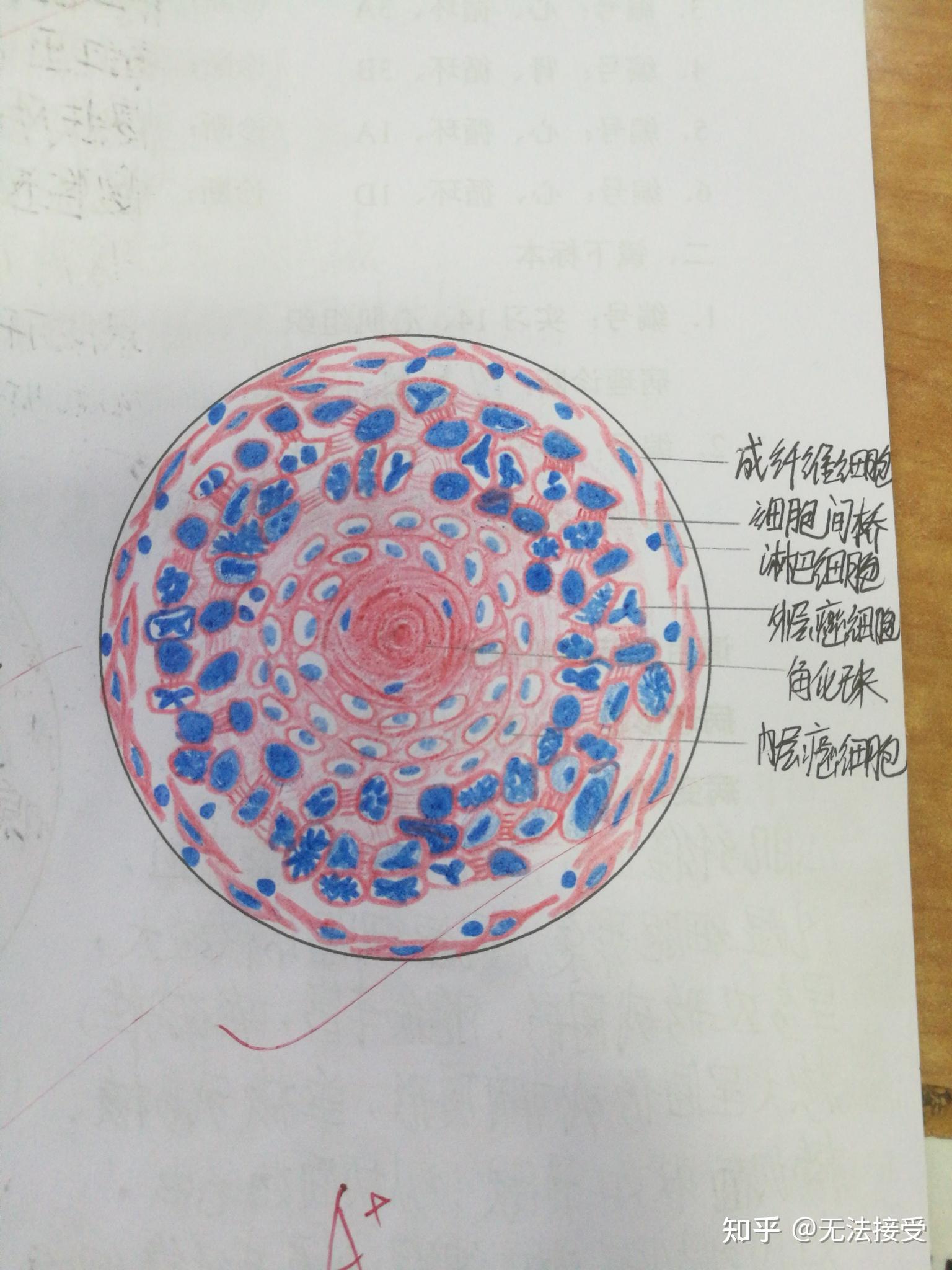 肠结核红蓝铅笔图图片