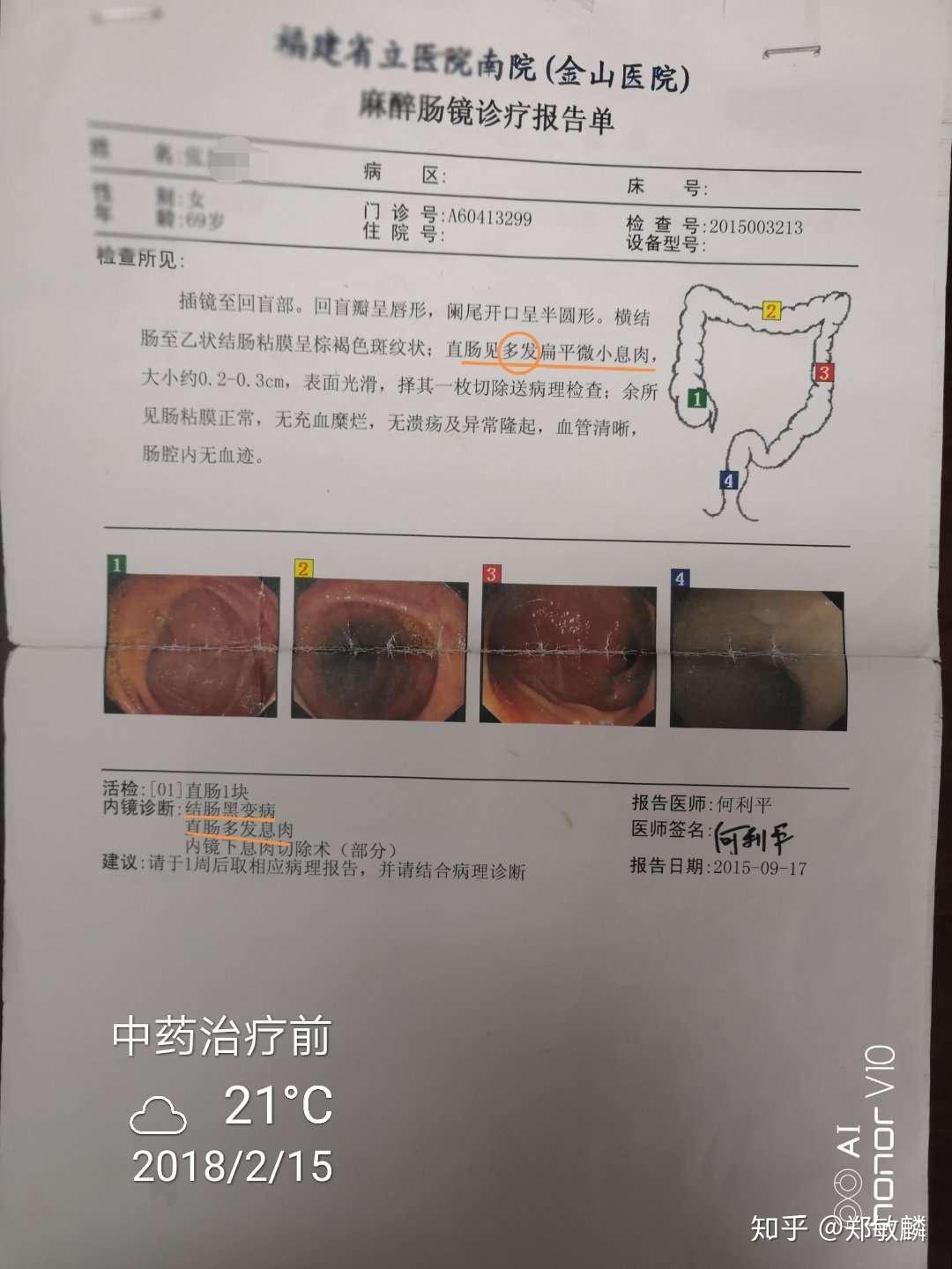 郑敏麟医案萎缩性胃炎伴肠化直肠多发息肉兼失眠案