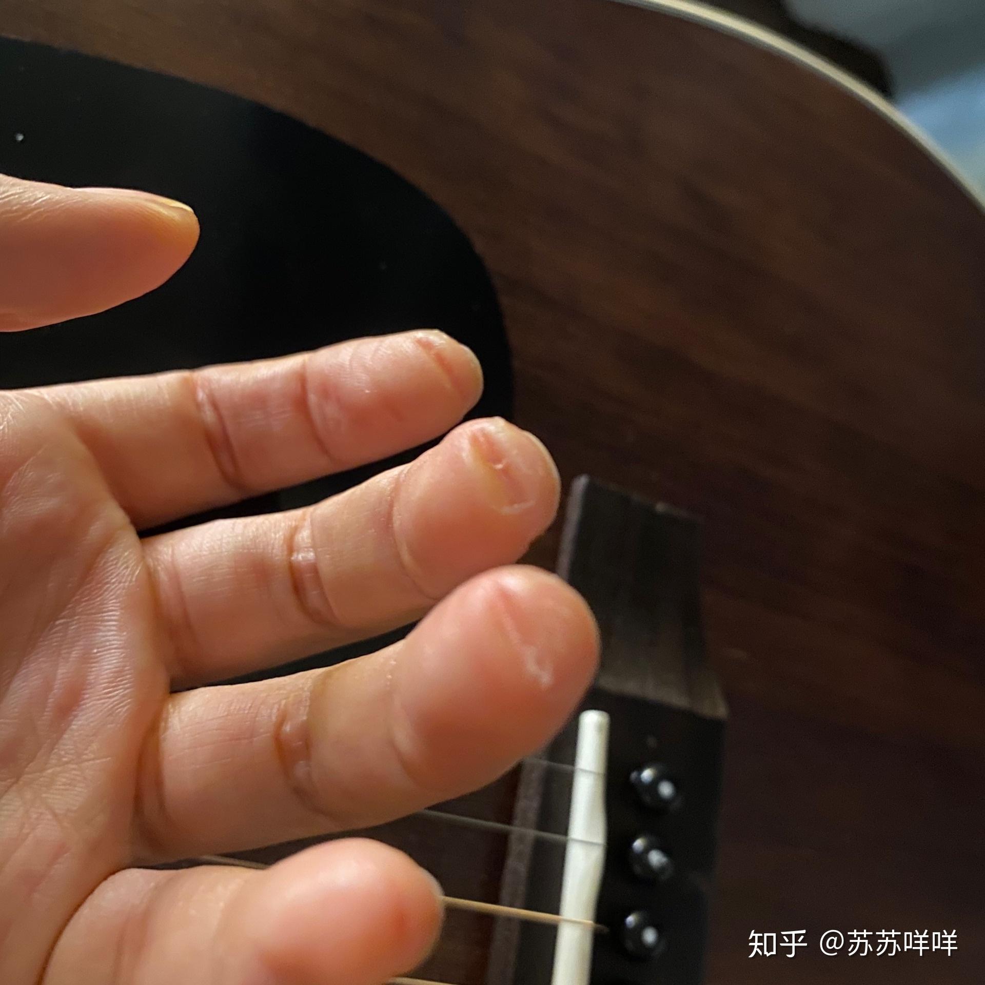玩吉他的朋友可以拍一张左手手指上的茧吗