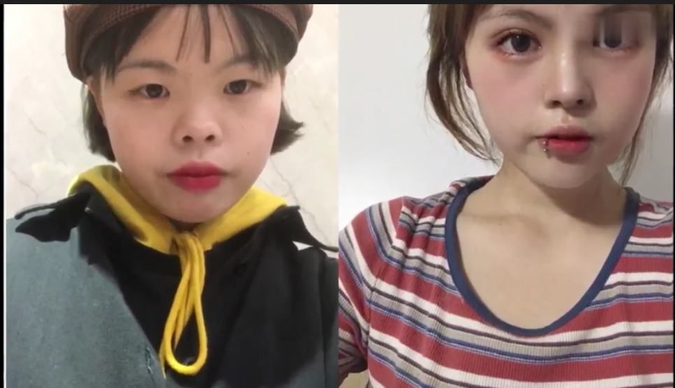 蒜头鼻和猪胆鼻的区别是什么?