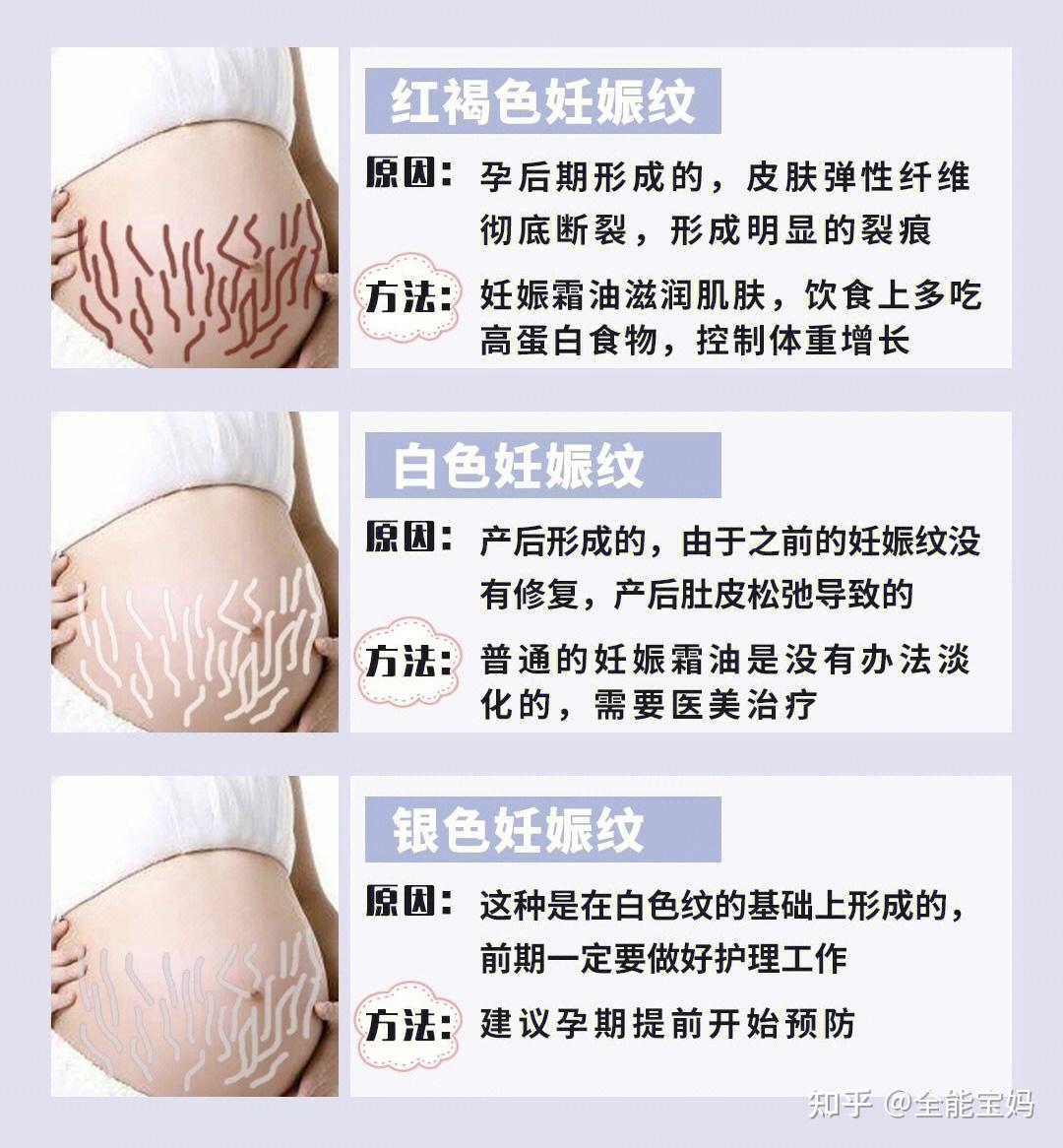 纹爵妊娠纹项目手册|平面|宣传品|mafengjin7823 - 原创作品 - 站酷 (ZCOOL)