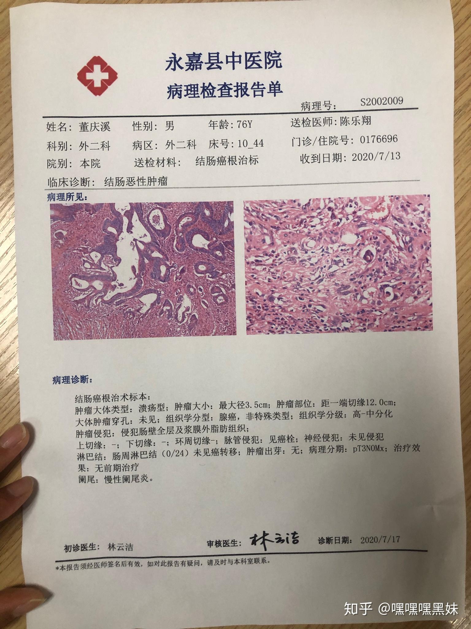 76岁老人结肠癌中期的治疗过程,给焦虑的子女一个参考吧