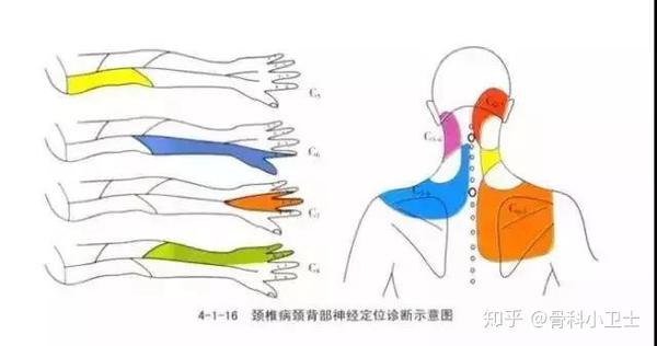 经常手麻绝不是忍一忍就过去了 背后可能有大问题 知乎