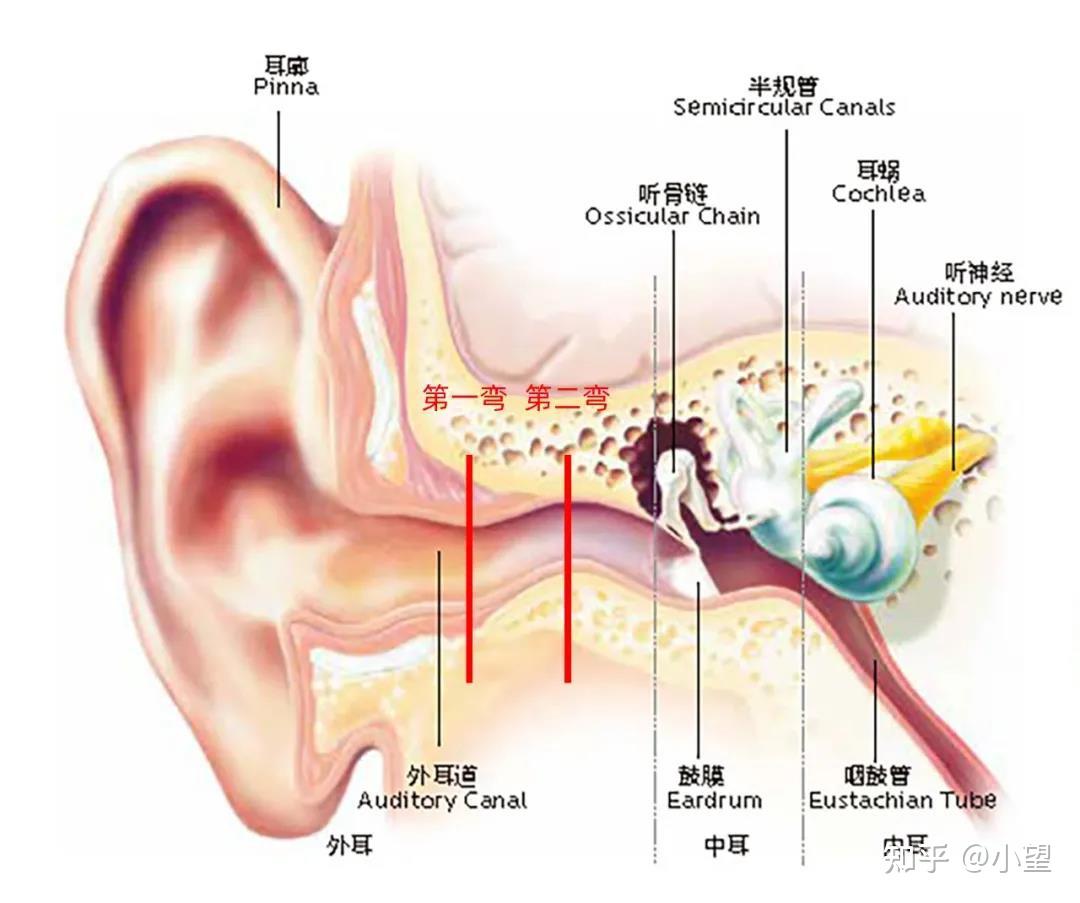 游泳时耳朵进水了怎么办?