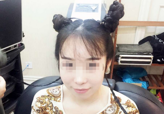 种植发际线安全吗,为什么几乎没见过女明星做