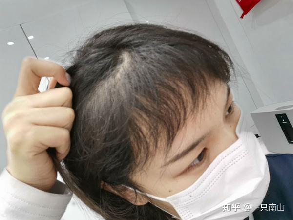 半年效果.