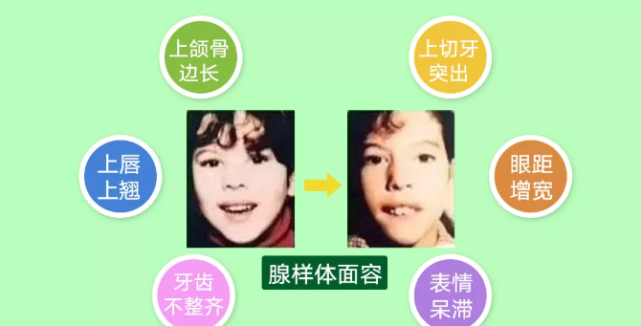 清鼻堂科普10歲男孩嘴唇上翻牙齒外凸醫生說了一番話後家長當場就哭了