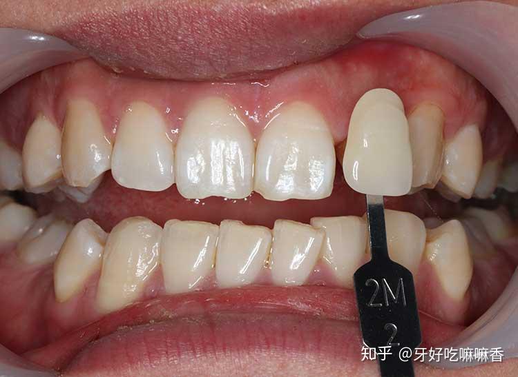 v2-97cb8e89ad9af200fc736231b8658ef1_r.jpg