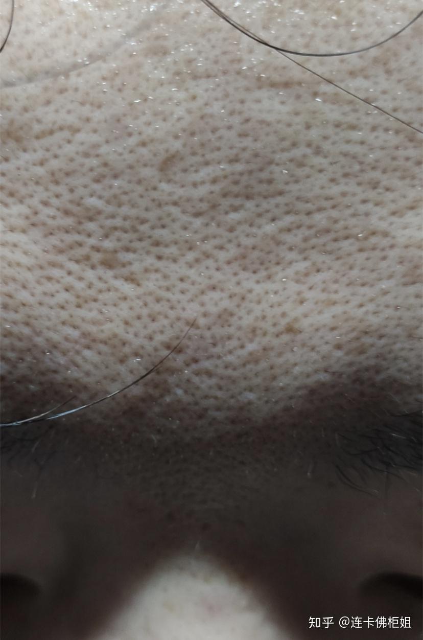 什么扎鼻成语_成语故事图片(3)