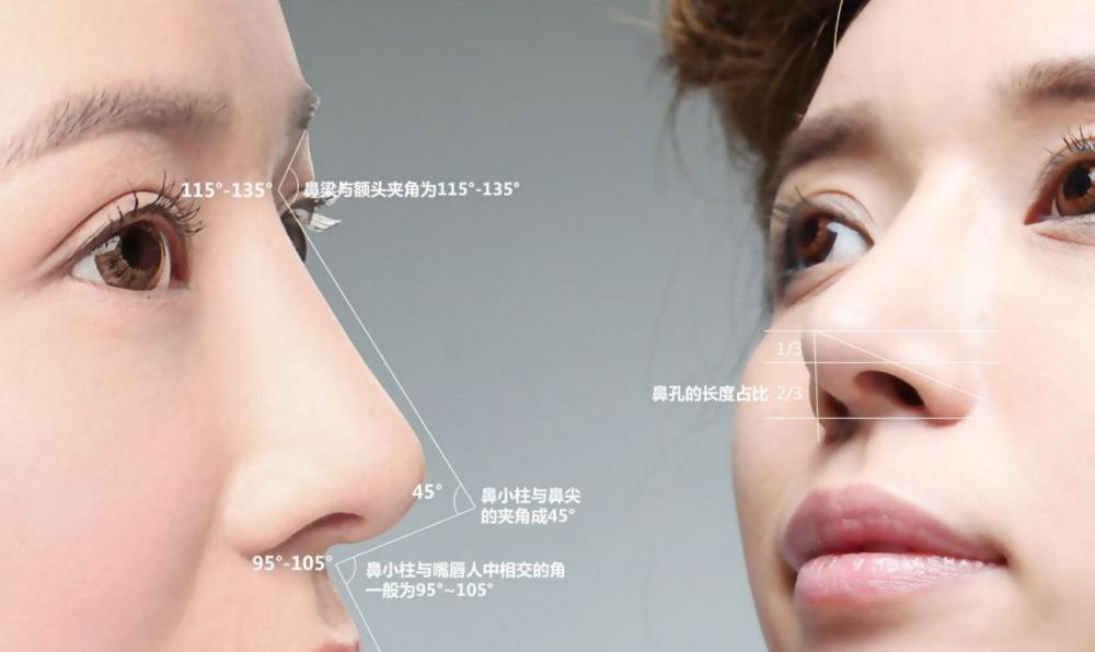 5步改善鼻翼宽、塌鼻梁、变美拥有高鼻梁 - 知乎