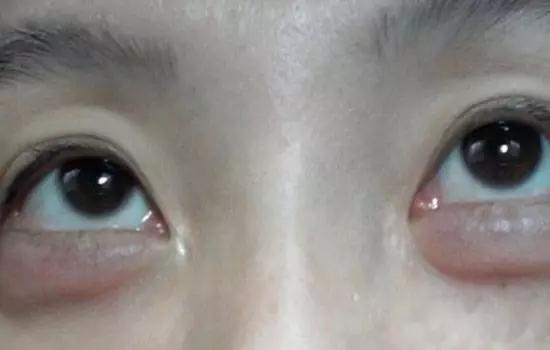 怎么做才能有卧蚕 v2-9849761b6a25ce7662d4cf77752f4cd2_r.jpg