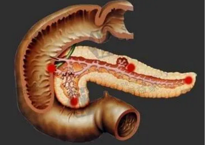 间充质干细胞 (mesenchymastem cels,mscs)在细胞治疗方面具有巨大的