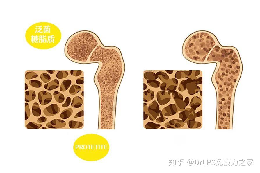 年轻人也要注意的事——骨骼健康 知乎 