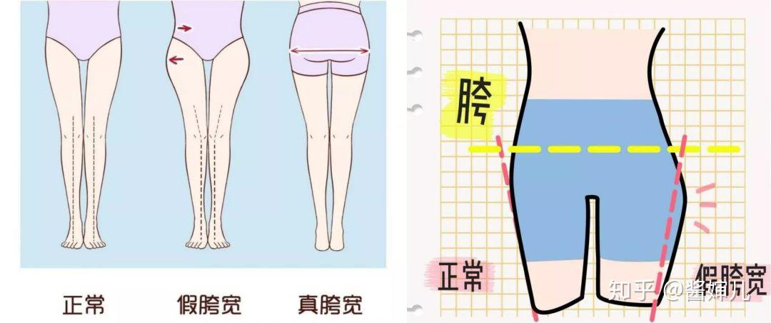 宽在体表上是可以摸到的,胯的宽度是髂骨两侧边缘的距离(看红色部分)