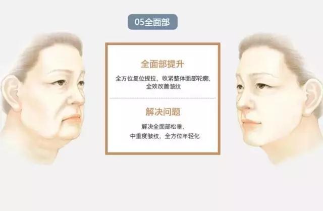 在家怎么做面部提升 v2-98c55e780e374d1a0b57a1690291a79d_r.jpg