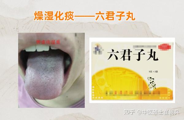 史上最全8种健脾祛湿中成药！学会全家受益 - 知乎