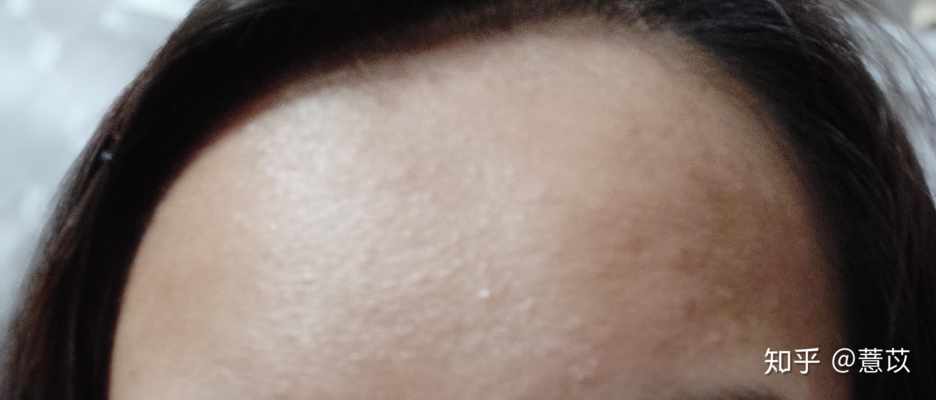 v2-992a1974fcecc1c77a31fdadf0b89781_r.jpg