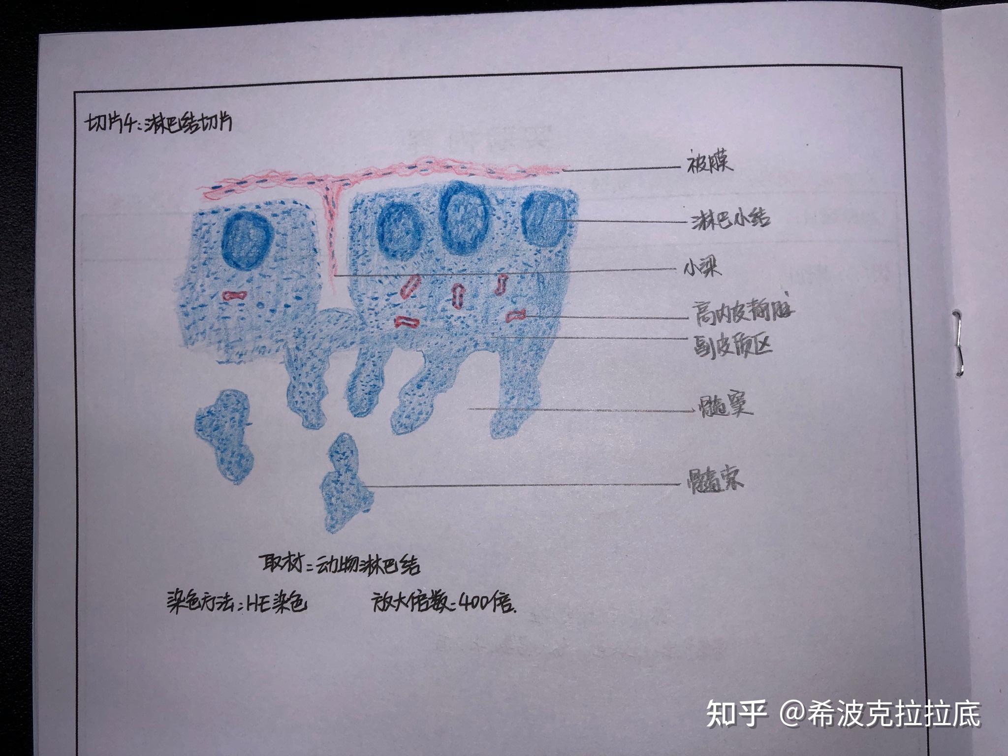 淋巴母细胞手绘图片图片