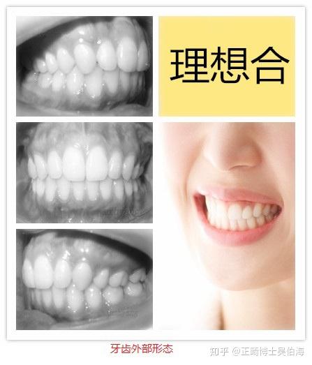 正常的牙齿排列是这个样子看看你的是否正常