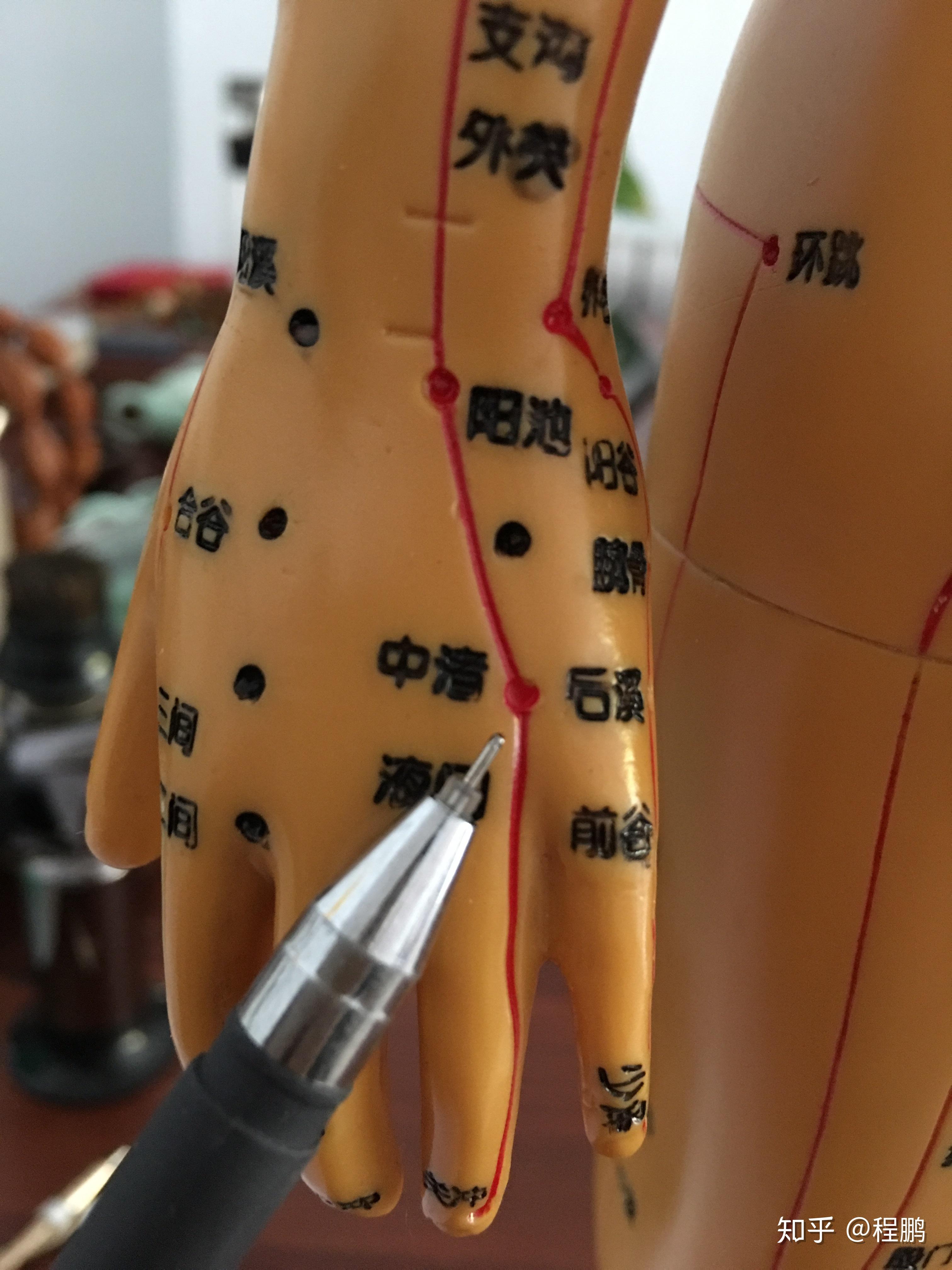 拔罐调理病症之落枕