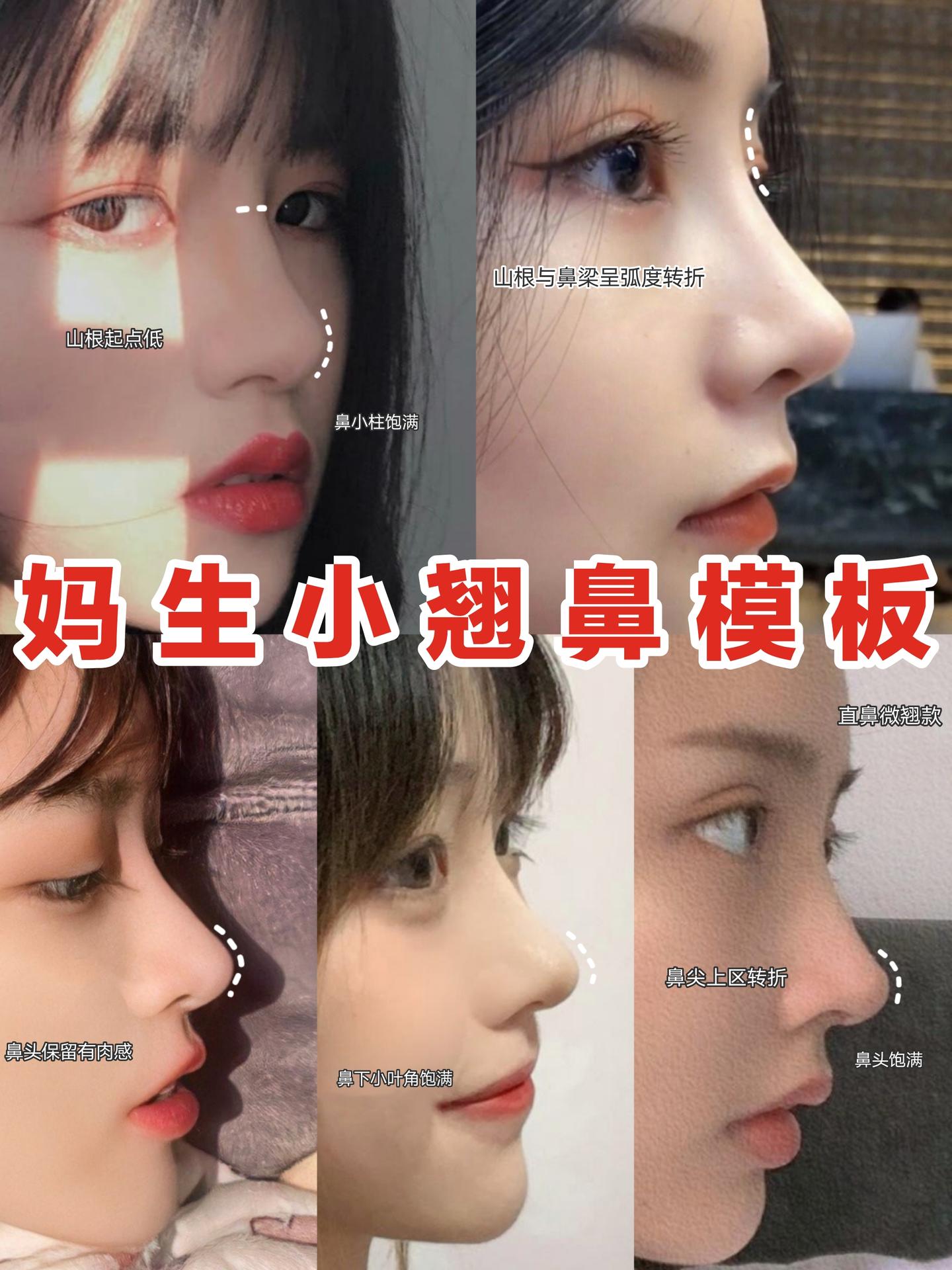 如何做出妈生小翘鼻 功课 案例 知乎 如何做出妈生小翘鼻 功课 案例 知乎